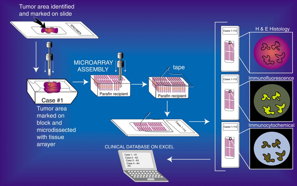 Tissue Microarray Process The Pathology Blog